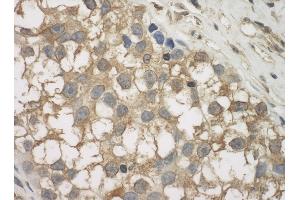 Immunohistochemistry (IHC) image for anti-Sperm Associated Antigen 9 (SPAG9) (AA 775-825) antibody (ABIN7454612)