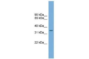 SLC35A4 antibody used at 0. (SLC35A4 antibody  (Middle Region))