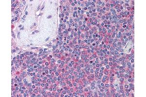 Anti-UBASH3A antibody IHC of human spleen. (UBASH3A antibody  (AA 417-430))