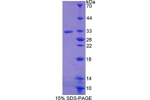 Image no. 1 for R-Spondin 3 (RSPO3) (AA 22-272) protein (His tag) (ABIN4990988) (R-Spondin 3 Protein (RSPO3) (AA 22-272) (His tag))