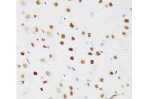 Immunohistochemistry of paraffin-embedded Mouse brain using CSRNP1 Polyclonal Antibody at dilution of 1:200 (40x lens).