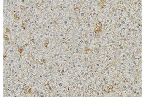 ABIN6274865 at 1/100 staining Mouse liver tissue by IHC-P. (Arylsulfatase A antibody  (Internal Region))