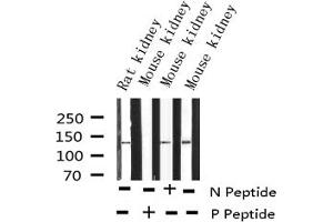 ENOS antibody  (pSer1177)