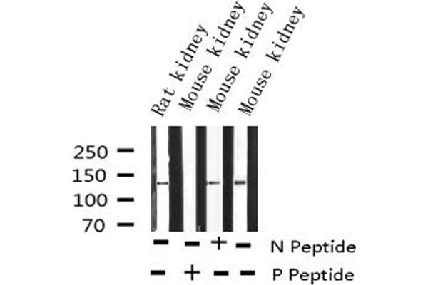 ENOS Antikörper  (pSer1177)