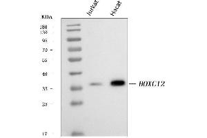 Western blot analysis of HOXC12 using anti-HOXC12 antibody (ABIN7599065).