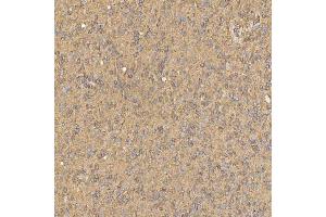 IHC analysis of SNX4 using anti-SNX4 antibody (ABIN7599406). (Sorting Nexin 4 antibody  (AA 1-450))