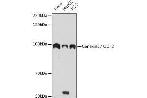 Western blot analysis of extracts of various cell lines, using Cenexin1 / ODF2 antibody (ABIN1680357, ABIN3017873, ABIN3017874 and ABIN7101531) at 1:1000 dilution. (ODF2 antibody)