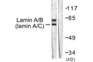 Western blot analysis of extracts from HeLa cells, using Lamin A/C (Ab-392) Antibody. (Lamin A/C antibody  (AA 361-410))