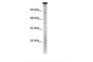 Image no. 2 for anti-TAF1 RNA Polymerase II, TATA Box Binding Protein (TBP)-Associated Factor, 250kDa (TAF1) (C-Term) antibody (ABIN6735891) (TAF1 antibody  (C-Term))