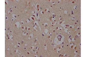 IHC image of ABIN7149488 diluted at 1:600 and staining in paraffin-embedded human brain tissue performed on a Leica BondTM system. (DACT1 antibody  (AA 410-525))