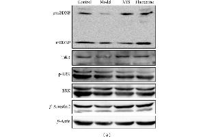 Representative Western blot analysis (a) and immunohistochemical staining (b) of BDNF, TrkB, p-ERK, ERK, and β-arrestin 2 in the hippocampus. (TRKB antibody  (AA 401-500))