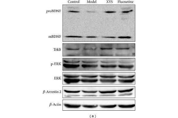 TRKB anticorps  (AA 401-500)