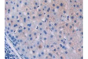 Used in DAB staining on fromalin fixed paraffin- embedded stomach tissue (IL18R1 antibody  (AA 147-255))