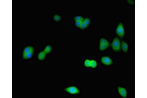 Immunofluorescence staining of HepG2 cells with ABIN7148865 at 1:266, counter-stained with DAPI. (CDK2 antibody  (AA 1-298))