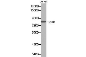 Western blot analysis of extracts of Jurkat cell line, using PPIG antibody. (PPIG antibody  (AA 1-100))