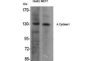Western Blot (WB) analysis of specific cells using A Cyclase I Polyclonal Antibody. (ADCY1 antibody  (Internal Region))