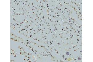IHC analysis of RPA32/RPA2 using anti-RPA32/RPA2 antibody (ABIN7601379). (RPA2 antibody  (AA 34-254))