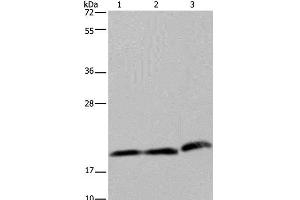 Western Blot analysis of Hela and K562 cell, Human fetal liver tissue using PGLYRP1 Polyclonal Antibody at dilution of 1:200