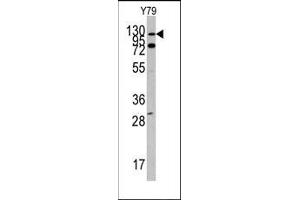 Image no. 1 for anti-C-Abl Oncogene 1, Non-Receptor tyrosine Kinase (ABL1) (N-Term) antibody (ABIN359967) (ABL1 antibody  (N-Term))