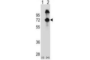Western blot analysis of ASPSCR1 (arrow) using rabbit polyclonal ASPSCR1 Antibody (N-term) . (ASPSCR1 antibody  (N-Term))