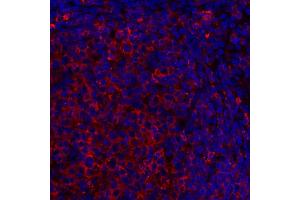 Immunofluorescence (IF) image for anti-HLA-DR (HLA-DR) antibody (ABIN7449537) (HLA-DR antibody)