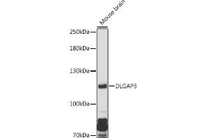 Western blot analysis of extracts of Mouse brain, using DLG antibody (ABIN7266791) at 1:1000 dilution. (DLGAP3 antibody  (AA 1-100))