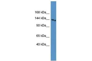 WB Suggested Anti-SLC4A5 Antibody Titration: 0. (NBC4 antibody  (N-Term))