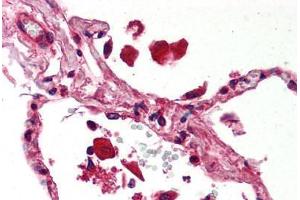 Human Lung (formalin-fixed, paraffin-embedded) stained with STAT1 antibody ABIN239822 at 5 ug/ml followed by biotinylated anti-mouse IgG secondary antibody ABIN481714, alkaline phosphatase-streptavidin and chromogen. (STAT1 antibody)