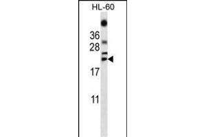 TNF Antibody (C-term) (ABIN657455 and ABIN2846482) western blot analysis in HL-60 cell line lysates (35 μg/lane). (TNF alpha antibody  (C-Term))