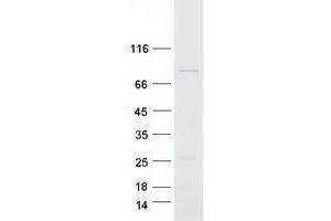 Validation with Western Blot (TOX Protein (Myc-DYKDDDDK Tag))