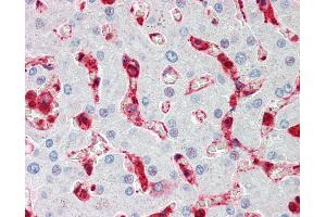 Anti-CFL1 / Cofilin antibody IHC staining of human liver. (Cofilin antibody  (AA 4-32))