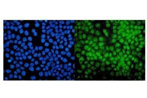 IF analysis of PIAS1 using anti-PIAS1 antibody (ABIN7602694). (PIAS1 antibody  (AA 96-300))