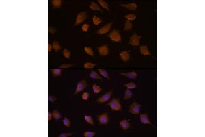 Immunofluorescence analysis of L929 cells using COMP Rabbit pAb (ABIN6127649, ABIN6138863, ABIN6138865 and ABIN6218152) at dilution of 1:100 (40x lens). (COMP antibody  (AA 20-160))