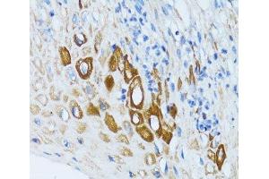 Immunohistochemistry of paraffin-embedded Human esophagus using PSRC1 Polyclonal Antibody at dilution of 1:100 (40x lens).