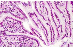 Human Small Intestine: Formalin-Fixed, Paraffin-Embedded (FFPE) (APEX1 antibody)