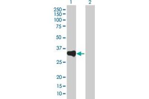 Lane 1: PSME3 transfected lysate ( 28.