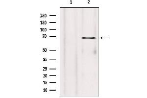 Western blot analysis of extracts from rat heart, using SYVN1 antibody.