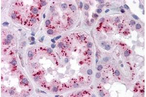 Human Kidney: Formalin-Fixed, Paraffin-Embedded (FFPE) (ZMYM4 antibody  (C-Term))