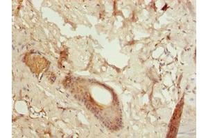 Immunohistochemistry of paraffin-embedded human skin tissue using ABIN7153448 at dilution of 1:100 (LGALS12 antibody  (AA 1-336))