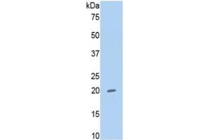 WB of Protein Standard: different control antibodies  against Highly purified E. (MMP13 ELISA Kit)