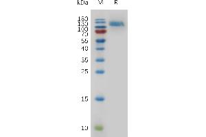 Mouse EGFR Protein, His Tag on SDS-PAGE under reducing condition.