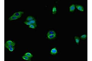 Immunofluorescent analysis of HepG2 cells using ABIN7142614 at dilution of 1:100 and Alexa Fluor 488-congugated AffiniPure Goat Anti-Rabbit IgG(H+L) (Serotonin Receptor 1A antibody  (AA 230-334))