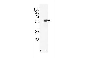 Western blot analysis of OPN-a/b (arrow) using rabbit polyclonal OPN-a/b Antibody (N-term) (ABIN655514 and ABIN2845029). (OPN-A,b (AA 14-40), (N-Term) antibody)