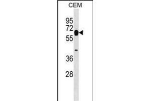 MYOT Antibody (Center) (ABIN1537809 and ABIN2848870) western blot analysis in CEM cell line lysates (35 μg/lane).