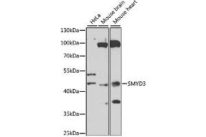 Western blot analysis of extracts of various cell lines, using SMYD3 antibody (ABIN6128709, ABIN6148169, ABIN6148170 and ABIN6223146) at 1:1000 dilution. (SMYD3 antibody  (AA 140-369))