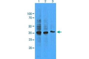 Western Blot analysis of HepG2 cell lysate (Lane 1: 1:500, Lane 2: 1:1000 and Lane 3: 1:5000) with AKR1C1 monoclonal antibody, clone AT6D10 . (AKR1C1 antibody)