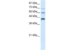 PRMT3 antibody used at 0. (PRMT3 antibody  (Middle Region))