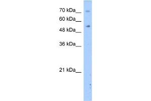 WB Suggested Anti-DPYS Antibody Titration:  2. (DPYS antibody  (N-Term))