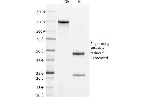 SDS-PAGE Analysis Purified Superoxide Dismutase 1 Mouse Monoclonal Antibody (SOD1/2089). (SOD1 antibody)