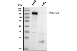 Western blot analysis of CD18/ITGB2 using anti-CD18/ITGB2 antibody (ABIN3043260). (Integrin beta 2 antibody  (AA 404-769))